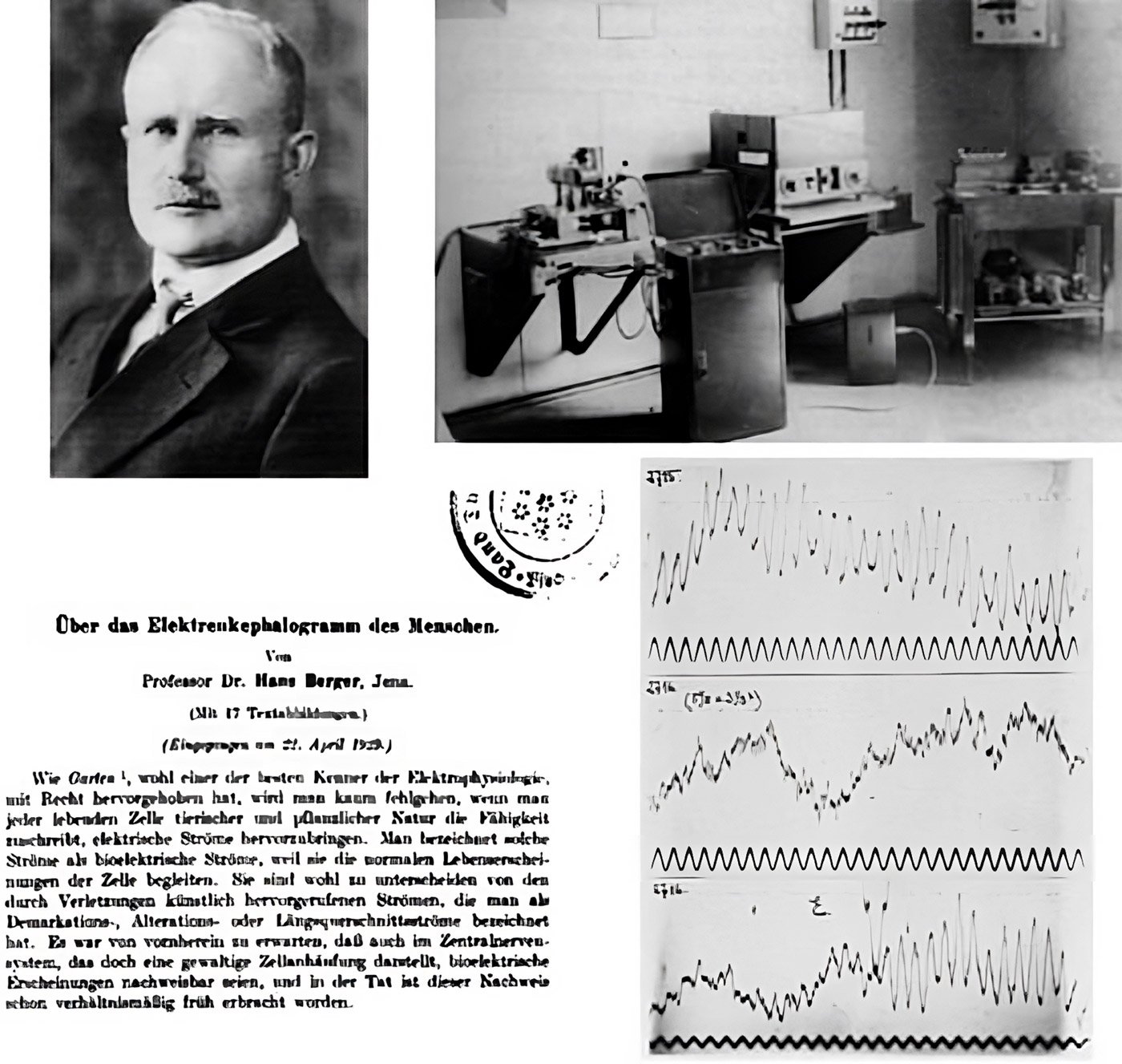 Hans Berger et le premier EEG