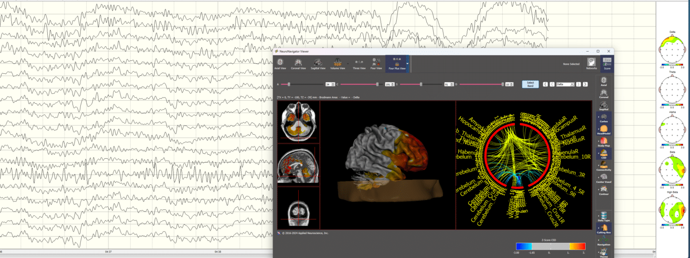 Modern neurofeedback technology and techniques in practice.